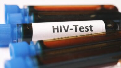 HIV-Test